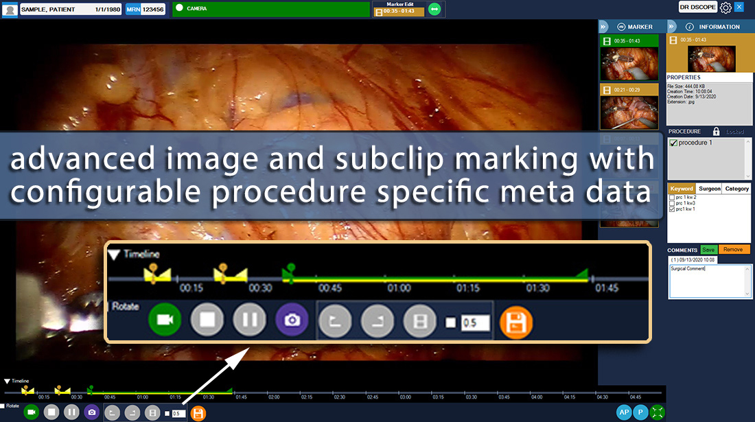 Operating Room Capture